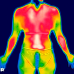 A Termografia Clínica Funcional é utilizada como método de diagnóstico capaz de apontar alterações fisiológicas que podem revelar a extensão de lesões e suas áreas dolorosas, antes mesmo que a dor apareça, sendo um exame indolor e sem contraste que possibilita a visualização das alterações térmicas da superfície cutânea.